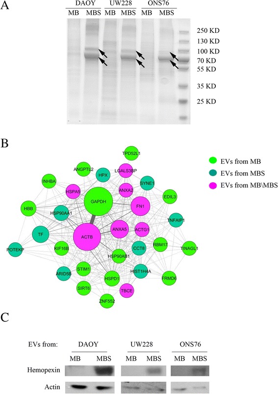 Proteomic analysis of extracellular vesicles from medullospheres reveals a role for iron in the cancer progression of medulloblastoma.