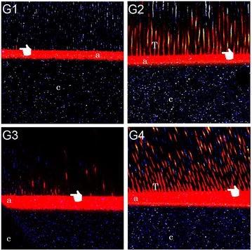 Effect of Bioglass 45S5 air-abrasion on dentin bonding: evaluation of microtensile bond strength and confocal microscopy