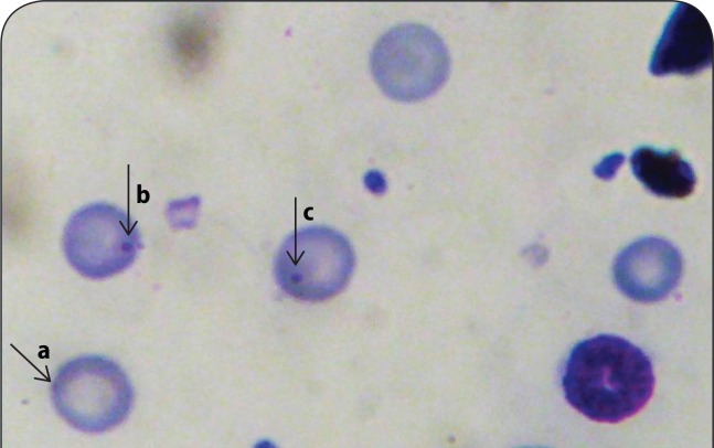 Genotoxicity and antigenotoxicity study of aqueous and hydro-methanol extracts of Spondias mombin L., Nymphaea lotus L. and Luffa cylindrical L. using animal bioassays.