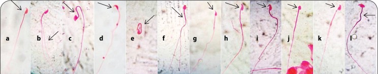 Genotoxicity and antigenotoxicity study of aqueous and hydro-methanol extracts of Spondias mombin L., Nymphaea lotus L. and Luffa cylindrical L. using animal bioassays.