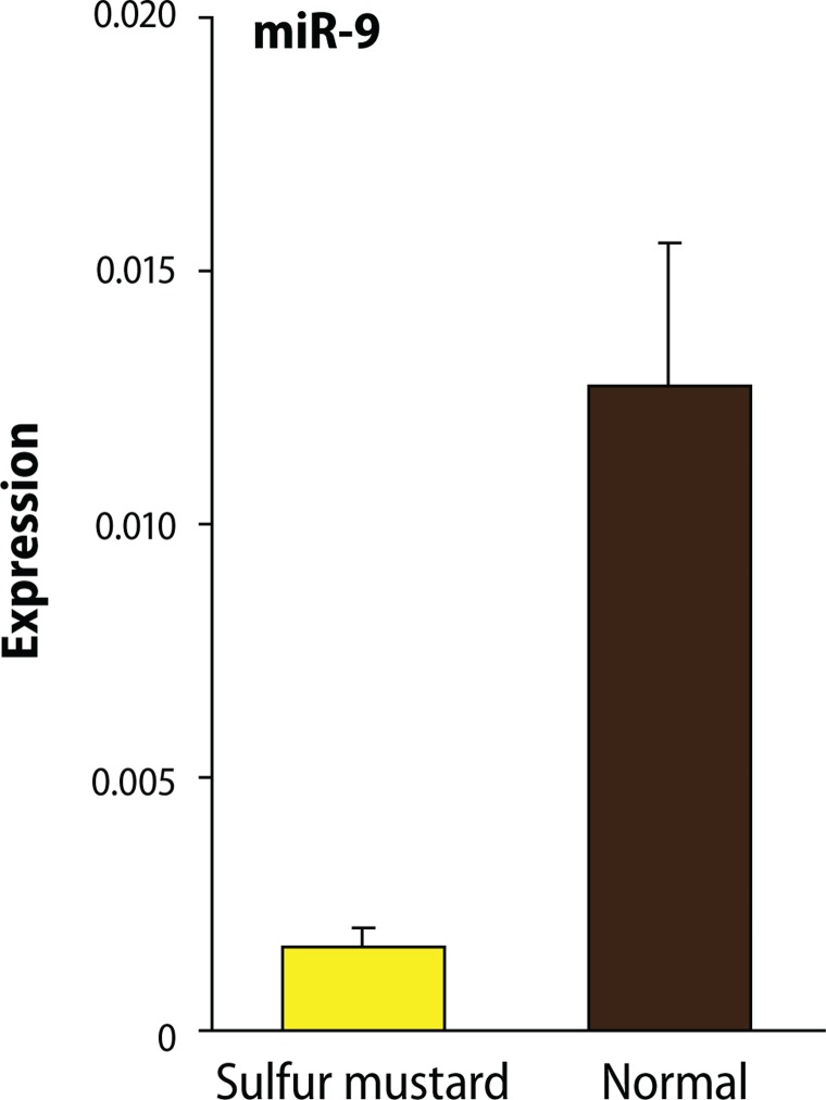 Evaluation of miR-9 and miR-143 expression in urine specimens of sulfur mustard exposed patients.