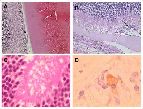 Experimental Models of Ocular Infection with Toxoplasma Gondii.