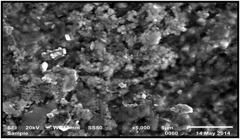 Translucency of monolithic and core zirconia after hydrothermal aging.