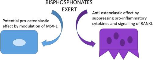 Implication of bisphosphonate use in the treatment of SAPHO syndrome: Case report and discussion of current literature