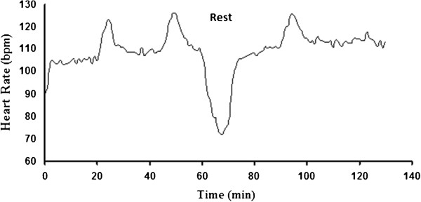 Physiological and cognitive military related performances after 10-kilometer march.