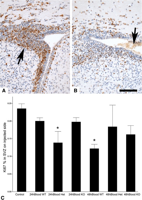 Interference with protease-activated receptor 1 does not reduce damage to subventricular zone cells of immature rodent brain following exposure to blood or blood plasma.