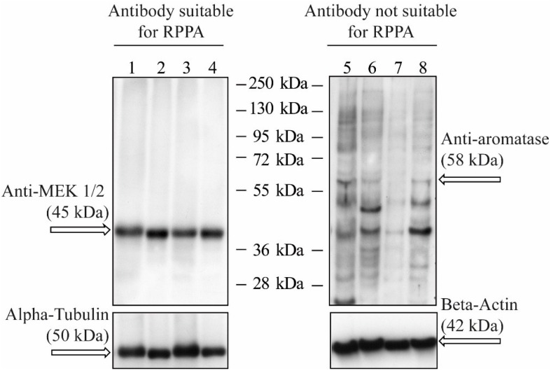 Reverse Phase Protein Arrays-Quantitative Assessment of Multiple Biomarkers in Biopsies for Clinical Use.