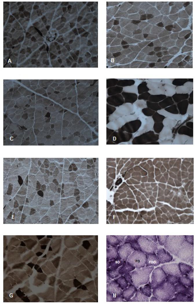 Fiber Composition of the Grasscutter (<i>Thryonomys swinderianus</i>, Temminck 1827) Thigh Muscle: An Enzyme-histochemical Study.