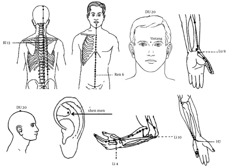 Acupressure and anxiety in cancer patients.