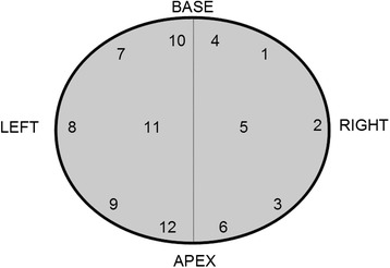 Length of prostate biopsies is not necessarily compromised by pooling multiple cores in one paraffin block: an observational study.