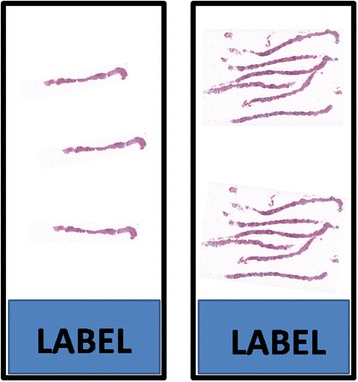 Length of prostate biopsies is not necessarily compromised by pooling multiple cores in one paraffin block: an observational study.