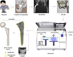 Constructing a 3D-printable, bioceramic sheathed articular spacer assembly for infected hip arthroplasty