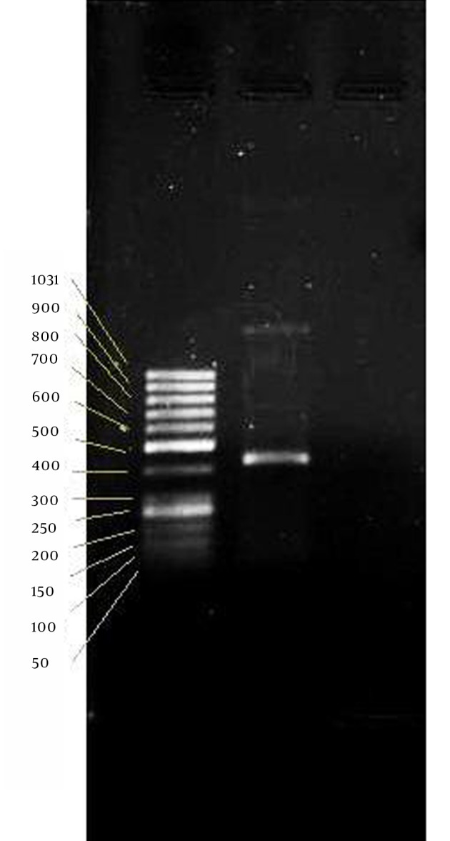Evaluation of In Vivo Transfection Efficiency of Eudragit Coated Nanoparticles of Chitosan-DNA: A pH-sensitive System Prepared for Oral DNA Delivery.
