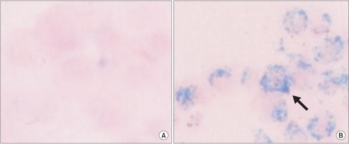 Use of nanoparticles to monitor human mesenchymal stem cells transplanted into penile cavernosum of rats with erectile dysfunction.