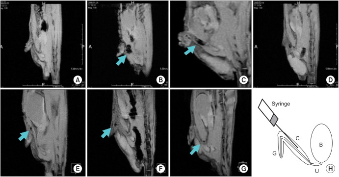 Use of nanoparticles to monitor human mesenchymal stem cells transplanted into penile cavernosum of rats with erectile dysfunction.