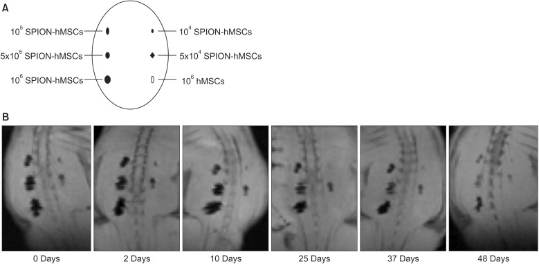 Use of nanoparticles to monitor human mesenchymal stem cells transplanted into penile cavernosum of rats with erectile dysfunction.