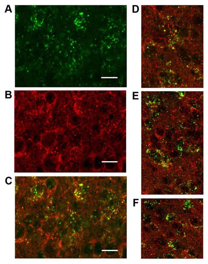 Rhythmic Trafficking of TRPV2 in the Suprachiasmatic Nucleus is Regulated by Prokineticin 2 Signaling.