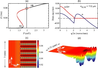 Noise-induced precursors of state transitions in the stochastic Wilson-cowan model.