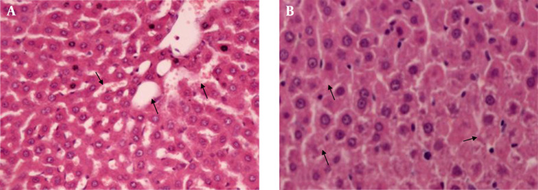 Evaluation of the protective effect of silibinin against diazinon induced hepatotoxicity and free-radical damage in rat liver.