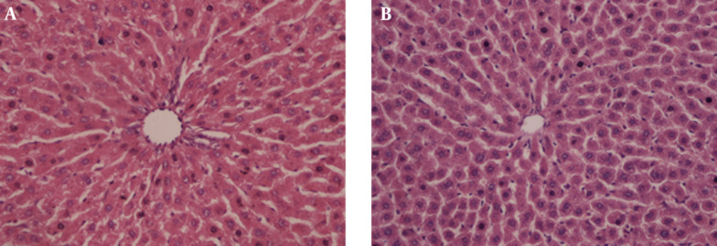Evaluation of the protective effect of silibinin against diazinon induced hepatotoxicity and free-radical damage in rat liver.