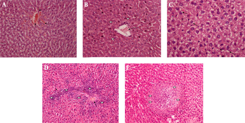 Evaluation of the protective effect of silibinin against diazinon induced hepatotoxicity and free-radical damage in rat liver.