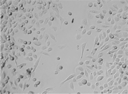 The effects of serum from prostate cancer patients with elevated body mass index on prostate cancer cells in vitro.