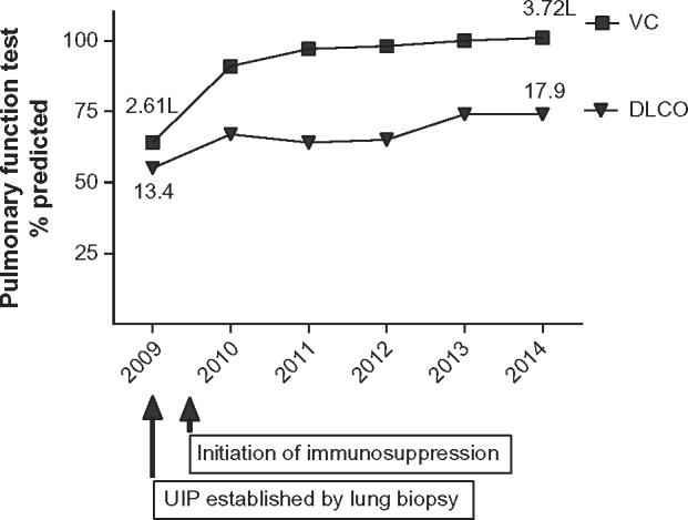 Normalization of lung function following treatment of secondary usual interstitial pneumonia: a case report.