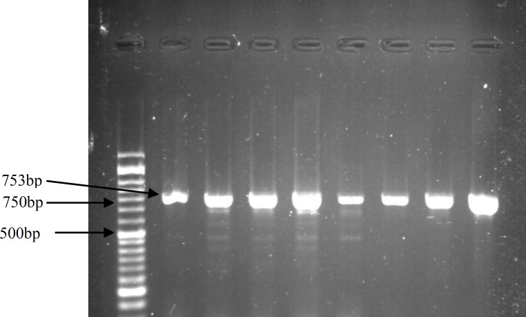 The association between single nucleotide polymorphism in interleukin-27 gene and recurrent pregnancy loss in Iranian women.