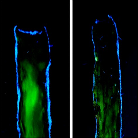 An experimental study of the effect of pre-operative administration of cilostazol on random skin flap survival in rats: double blinded randomized controlled trial.