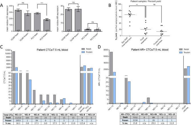 Detection and Characterization of Circulating Tumour Cells from Frozen Peripheral Blood Mononuclear Cells.