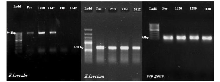 Spread of Enterococcal Surface Protein in Antibiotic Resistant Entero-coccus faecium and Enterococcus faecalis isolates from Urinary Tract Infections.