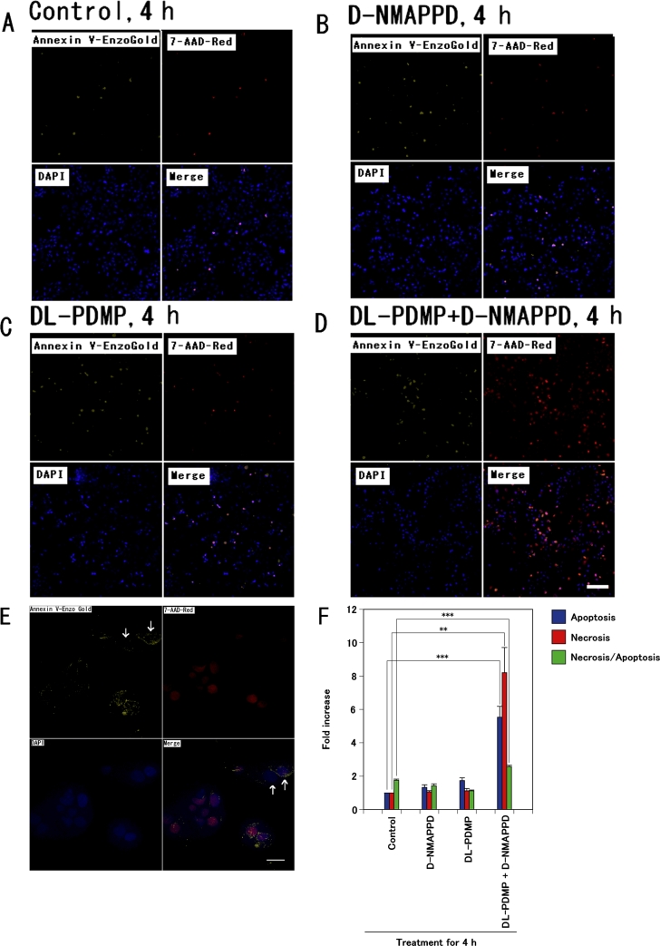 Palmitoyl-ceramide accumulation with necrotic cell death in A549 cells, followed by a steep increase in sphinganine content