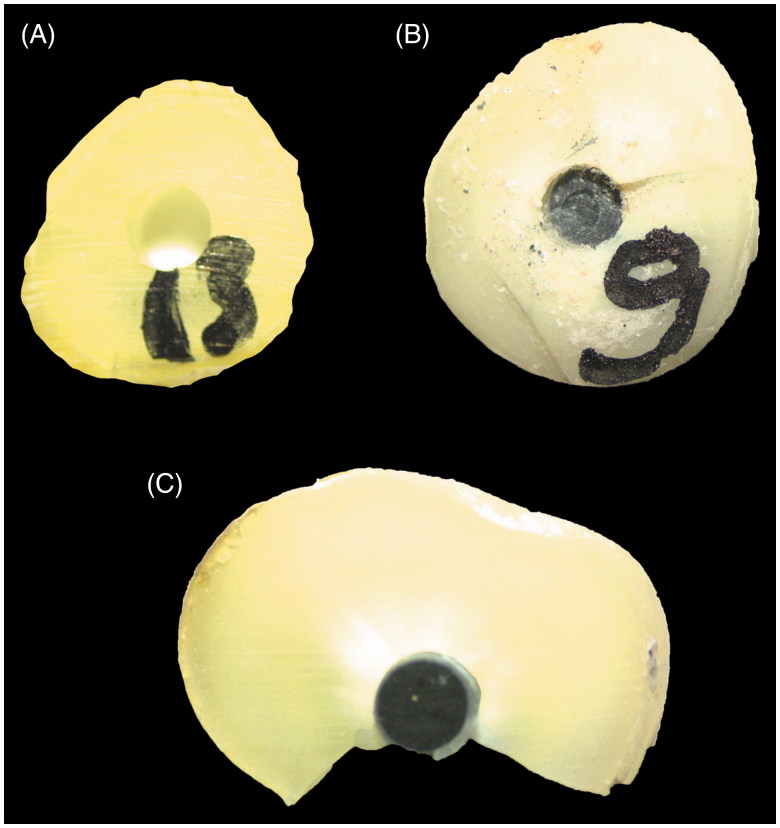 Effect of various intracanal medicaments on the bond strength of self-adhesive resin cement to root canal dentin.