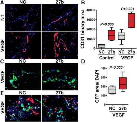 Therapeutic manipulation of angiogenesis with miR-27b.