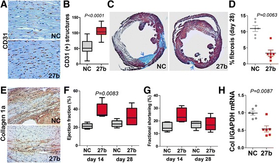 Therapeutic manipulation of angiogenesis with miR-27b.