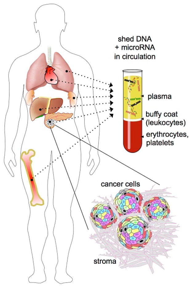 Circulating DNA and Micro-RNA in Patients with Pancreatic Cancer.