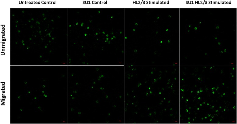 Sutherlandia frutescens may exacerbate HIV-associated neuroinflammation.