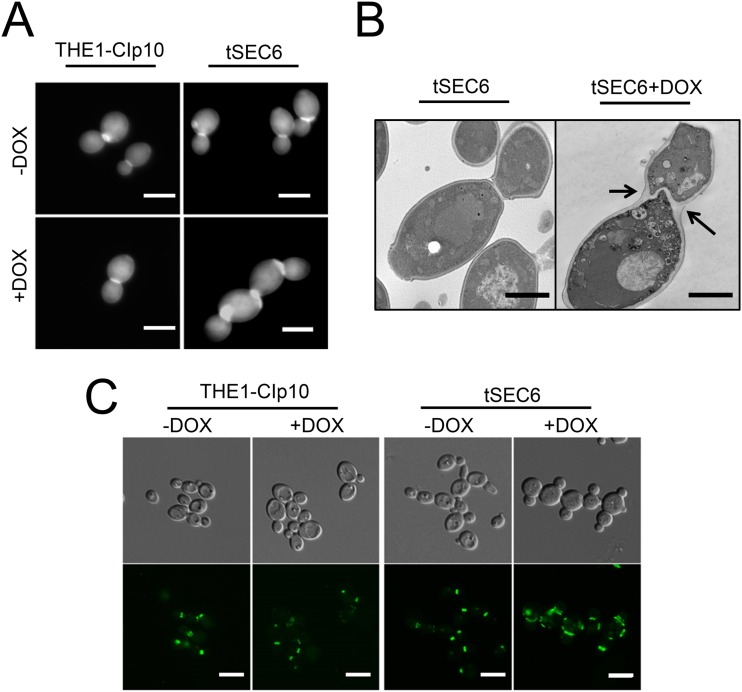 The Candida albicans Exocyst Subunit Sec6 Contributes to Cell Wall Integrity and Is a Determinant of Hyphal Branching.