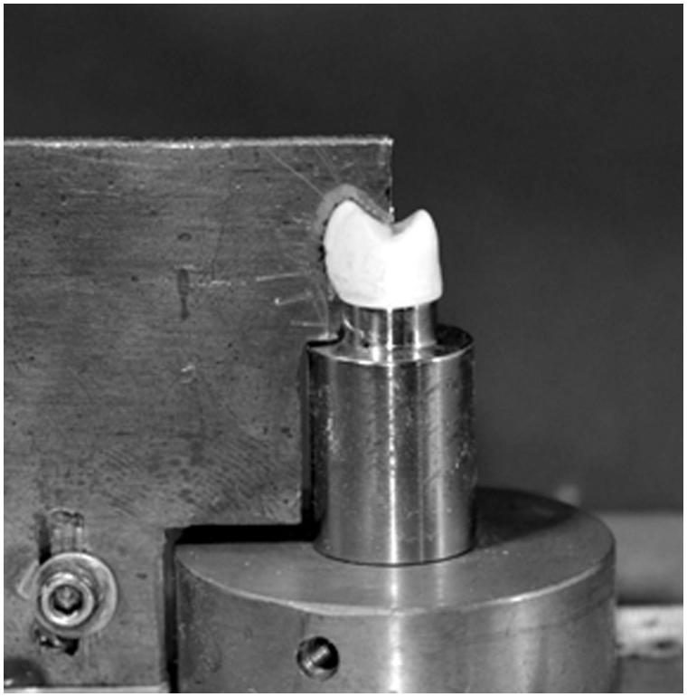 Fracture of porcelain-veneered gold-alloy and zirconia molar crowns using a modified test set-up.