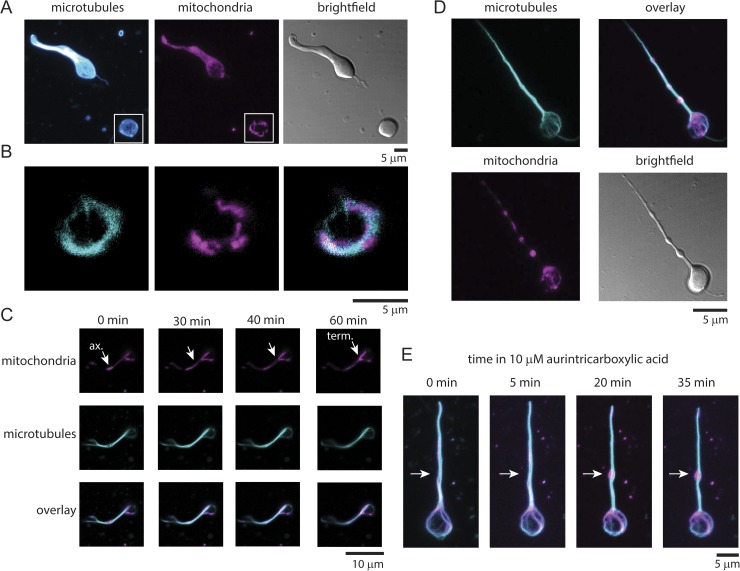 A marginal band of microtubules transports and organizes mitochondria in retinal bipolar synaptic terminals.