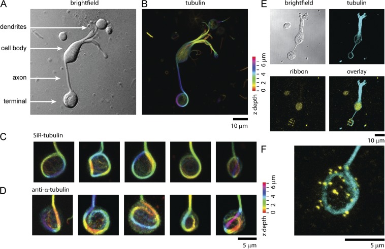 A marginal band of microtubules transports and organizes mitochondria in retinal bipolar synaptic terminals.