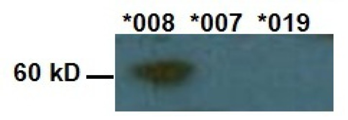 Allele Specific Expression of MICA Variants in Human Fibroblasts Suggests a Pathogenic Mechanism.