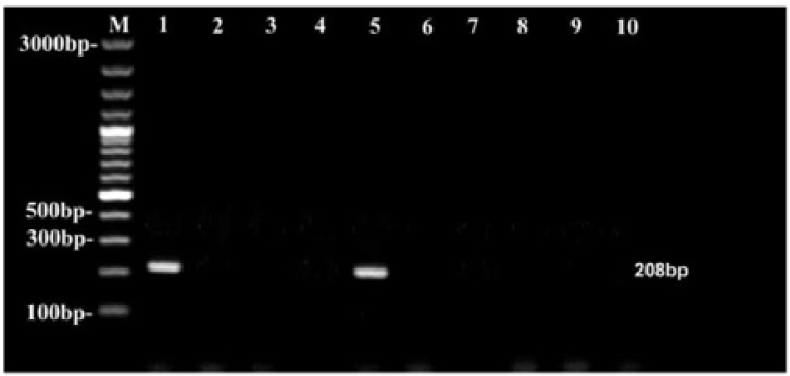 Association of Genital Chlamydia trachomatis Infection with Female Infer-tility, Study in a Tertiary Care Hospital in Eastern India.