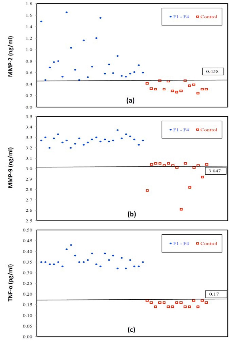 Plasma Levels of Matrix Metalloproteinase (MMP)-2, MMP-9 and Tumor Necrosis Factor-α in Chronic Hepatitis C Virus Patients.