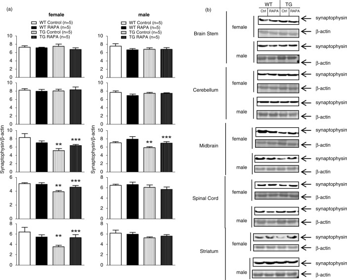 Rapamycin improves motor function, reduces 4-hydroxynonenal adducted protein in brain, and attenuates synaptic injury in a mouse model of synucleinopathy.