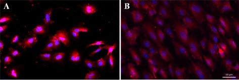 Mechanical stretch: physiological and pathological implications for human vascular endothelial cells.