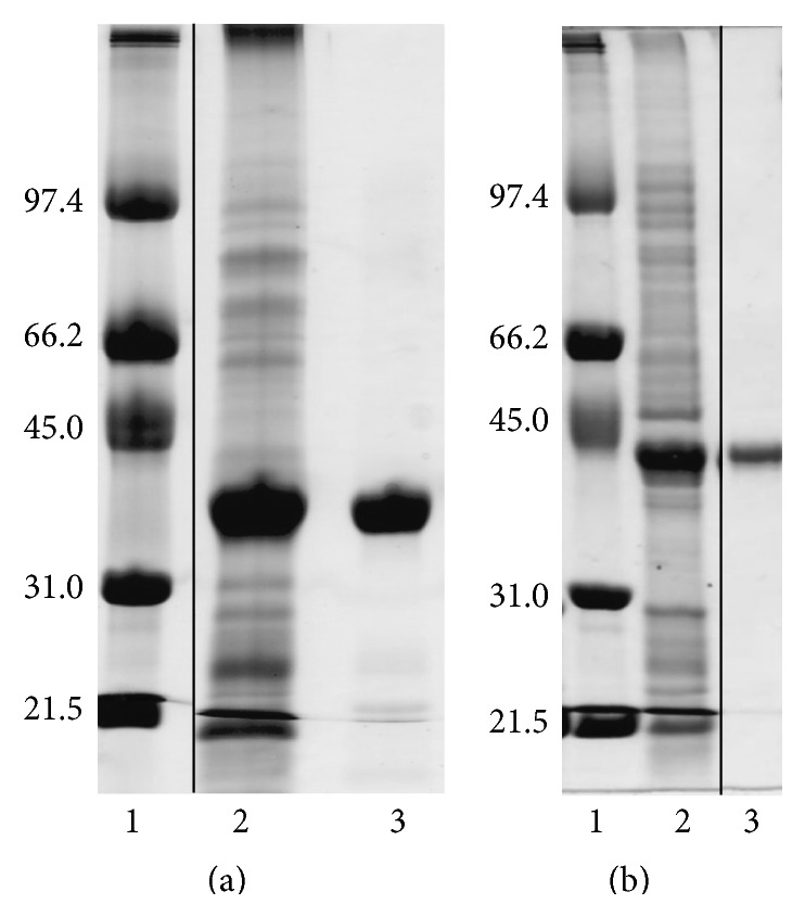 Biochemical Characterisation of Phage Pseudomurein Endoisopeptidases PeiW and PeiP Using Synthetic Peptides.