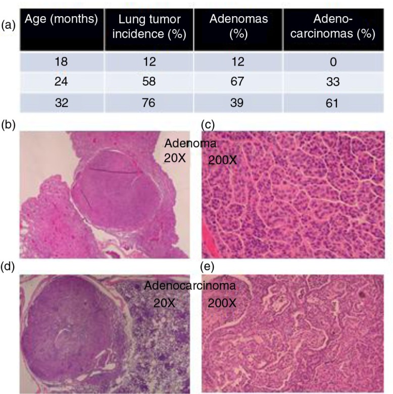 Mitochondrial catalase suppresses naturally occurring lung cancer in old mice.