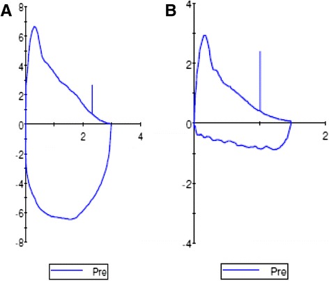 Vocal cord dysfunction: a review.