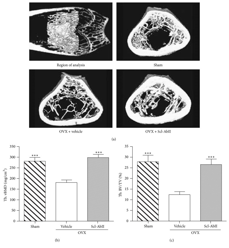 Sclerostin Antibody Therapy for the Treatment of Osteoporosis: Clinical Prospects and Challenges.